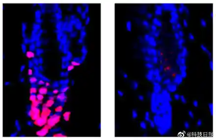 脱发星人的福音！科学家发现可治疗脱发的分子靶点