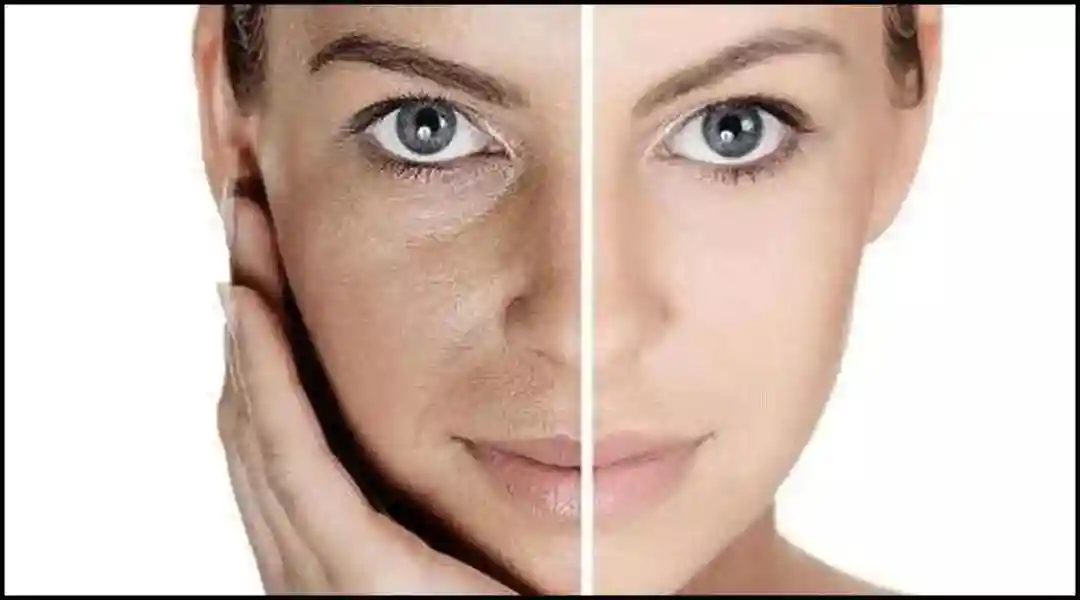 抗老、维稳、去暗沉！这瓶极光精华也太绝了