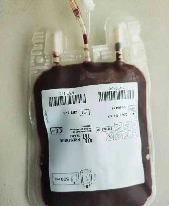 罕见且易误诊！这5项指标有助于鉴别PNH