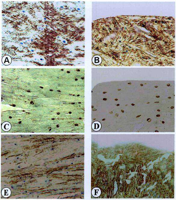 脂肪胶里掺了生长因子？就是普通脂肪？医生带你认识真正的脂肪胶