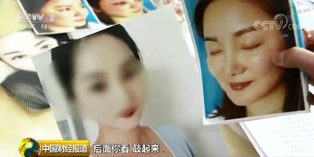 可怕！会缝衣服就会做双眼皮？培训三天可出师……