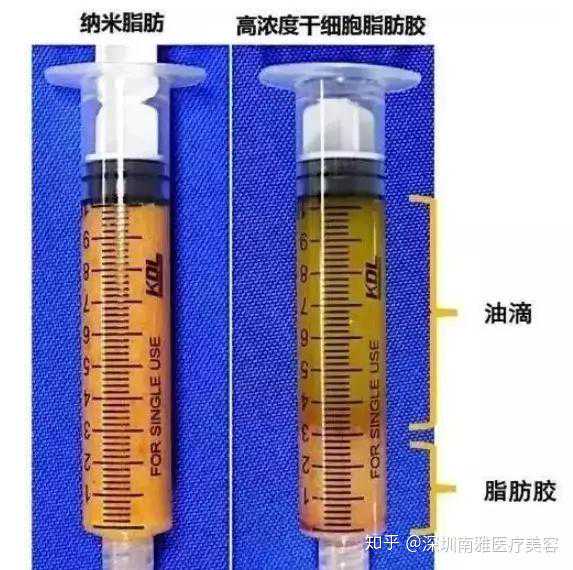 湖南42岁母亲患血癌，跟16岁儿子骨髓配型成功，网友阻止：别捐！