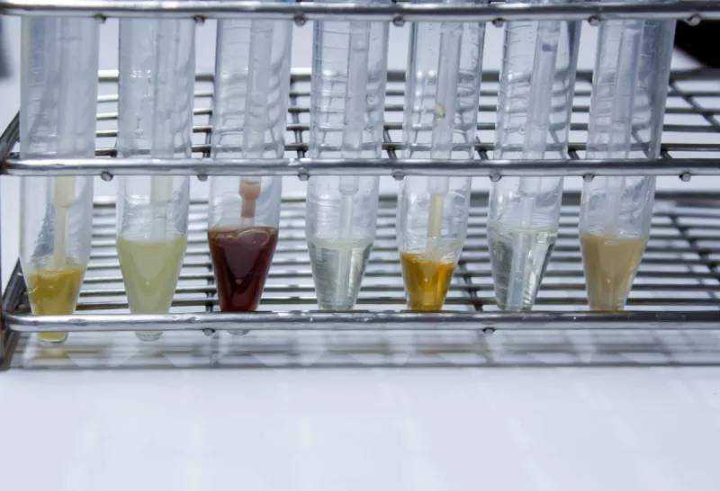 干细胞介入治疗阿尔茨海默症的研究案例