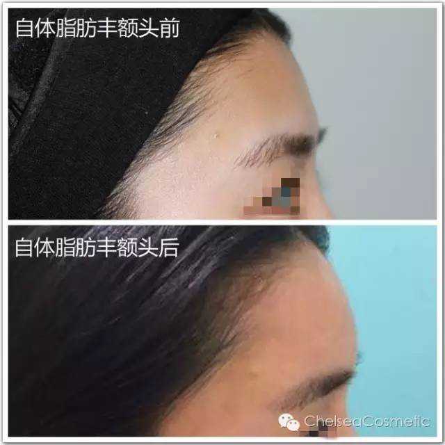 Vero细胞最佳生长条件的报道