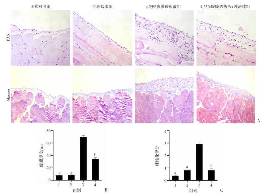 临床研究成果 | 这类系统性红斑狼疮,协和免疫团队提出精准分型指导治疗