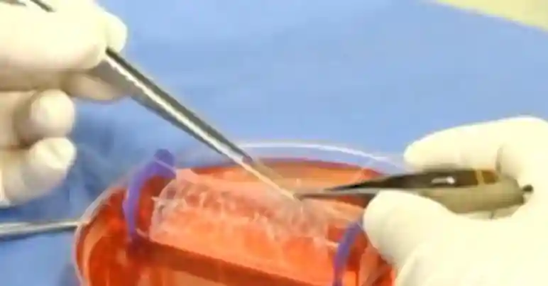 9大人造器官，人造子宫、大脑，人工角膜，你能消费得起几种？